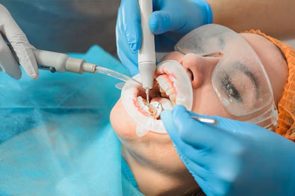 Oral Surgical Procedures