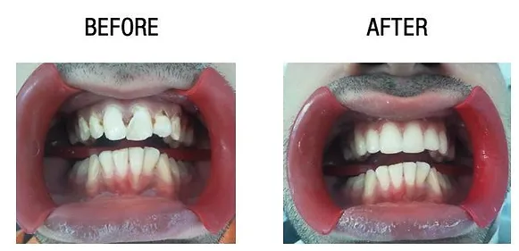 Dental surgery - before and after