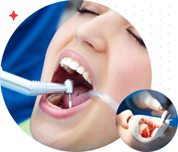 Advanced Root Canal Treatment