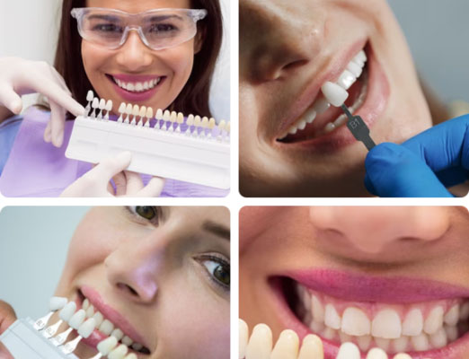 Custom Dentures & Veneers - DenTru New Gurgaon