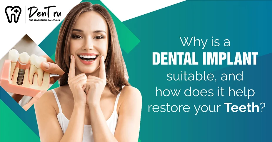 Why is A Dental Implant Suitable?