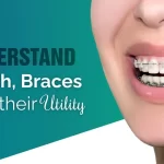 Understand Teeth, Braces, and Their Utility
