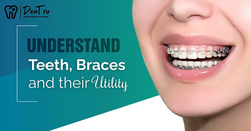 Understand Teeth, Braces, and Their Utility